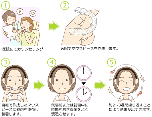 医院で作成したマウスポースに薬剤を塗布します。