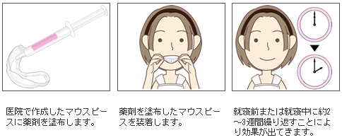 医院で作成したマウスポースに薬剤を塗布します。